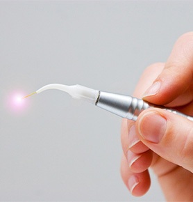 a hand holding a dental laser